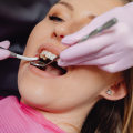 What are the disadvantages of deep cleaning teeth?