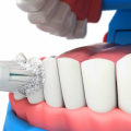 Is a dental deep cleaning ever really necessary?