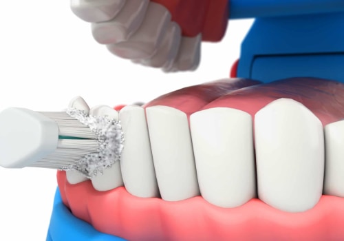 Is a dental deep cleaning ever really necessary?